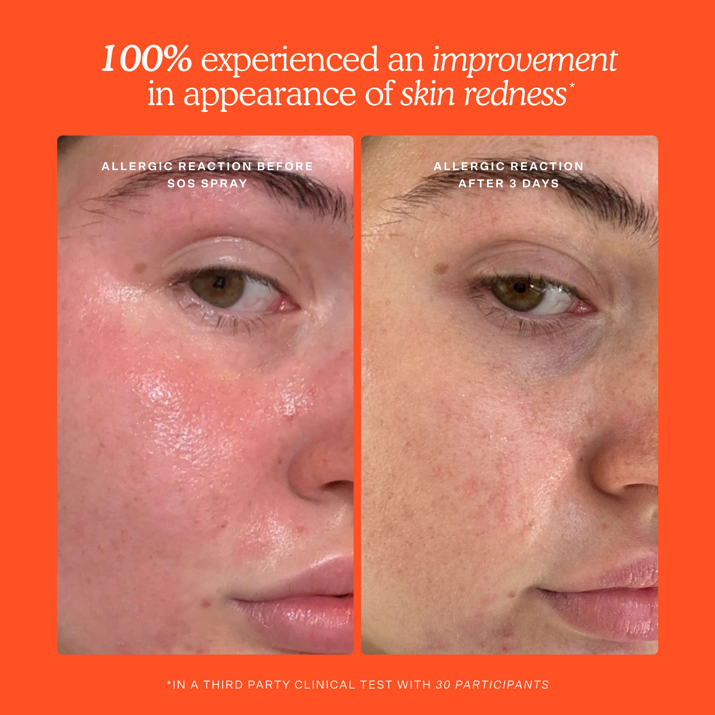 SOS Skincare Minis Kit